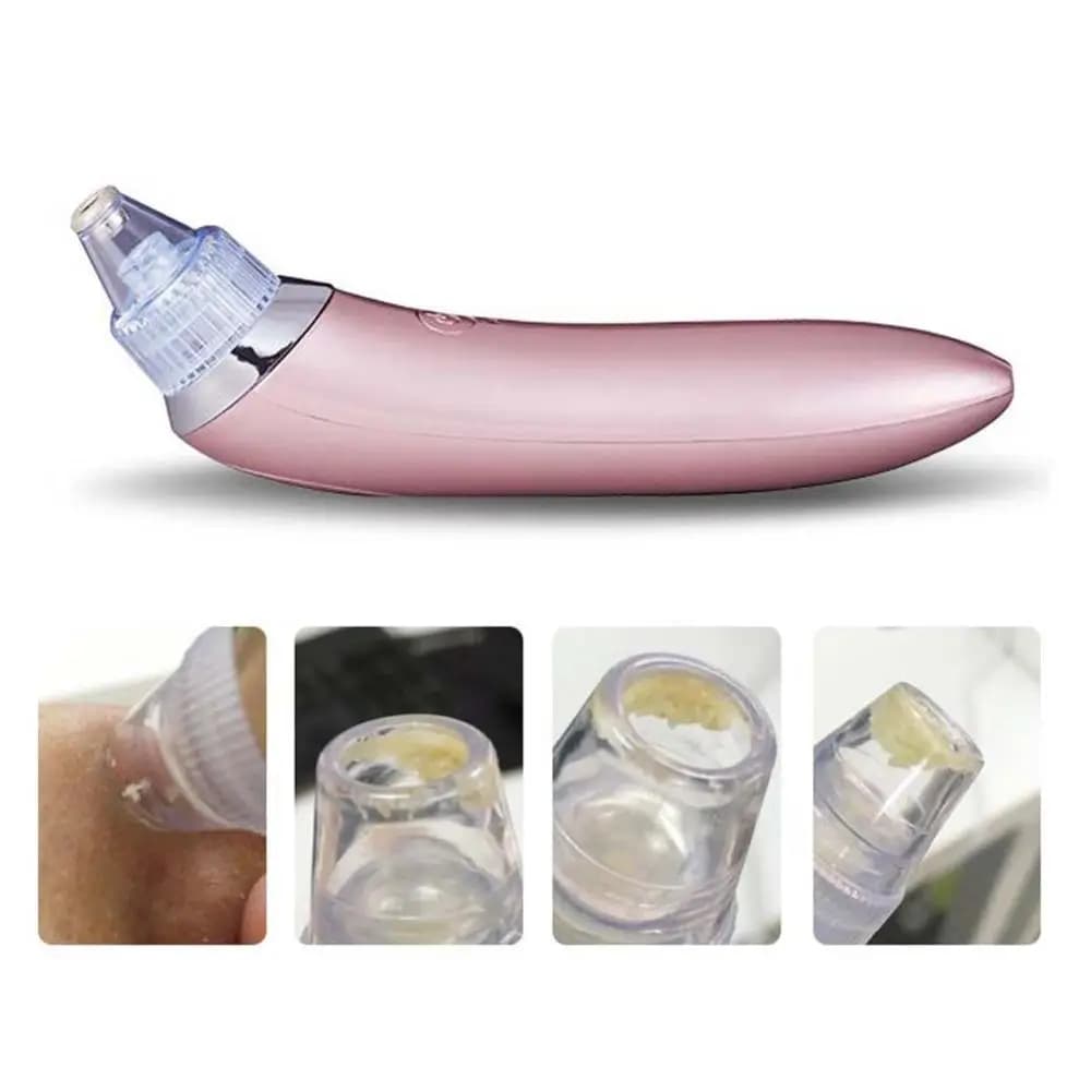 Face Pore Cleaner - Blackhead Remover | Vacuum Facial Cleaning Beauty Machine