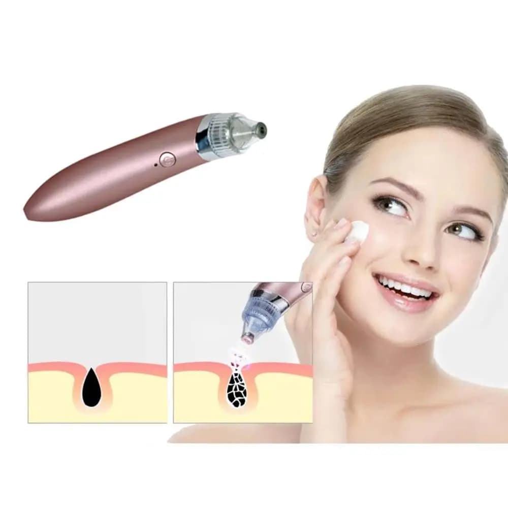 Face Pore Cleaner - Blackhead Remover | Vacuum Facial Cleaning Beauty Machine